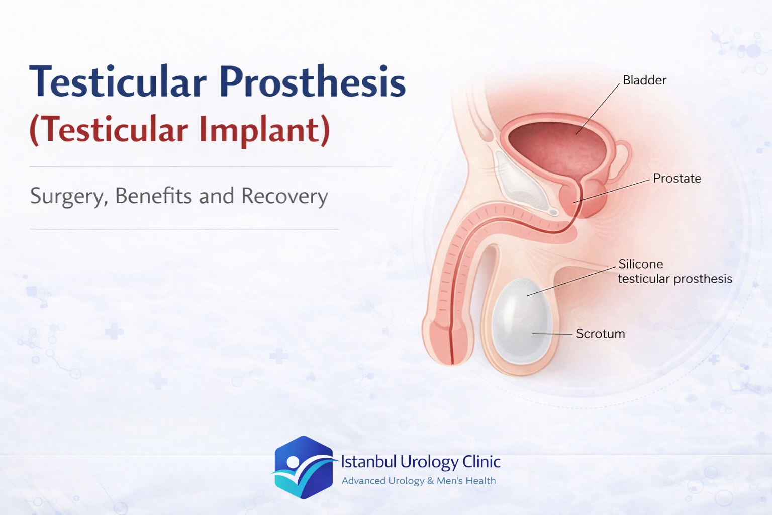 Testicular Implant: Surgery, Benefits and Recovery