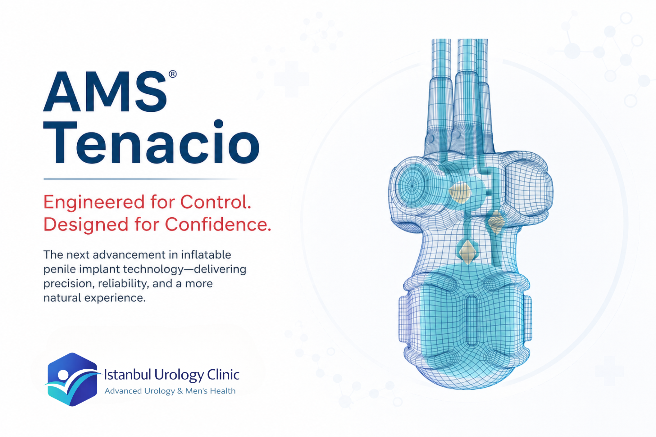 AMS 700 TENACIO Pump 2026: FDA-Approved Redesign Guide
