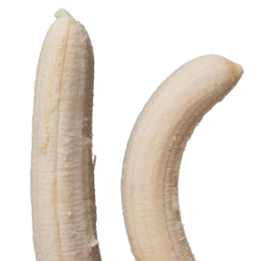 correzione Peyronie durante protesi peniena